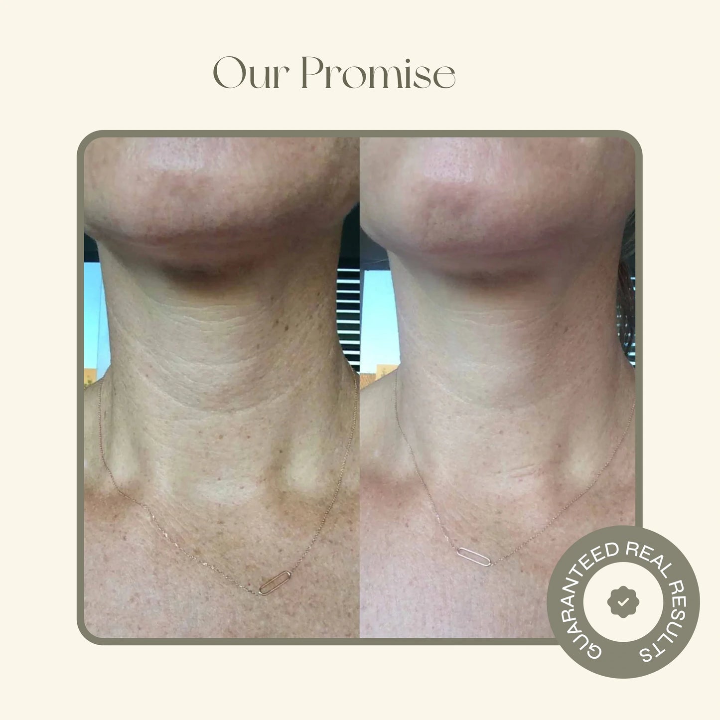 Neck Collagen Boosting Mask