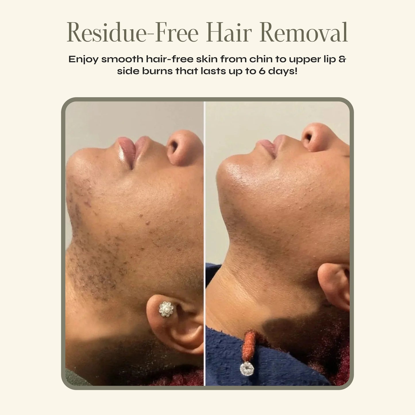 Facial Hair Removal Cream